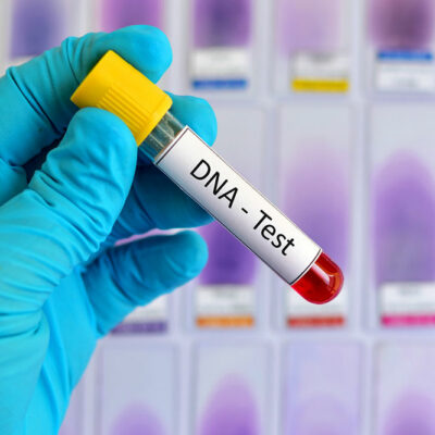 DNA Testing – Definition, Types, and Procedure